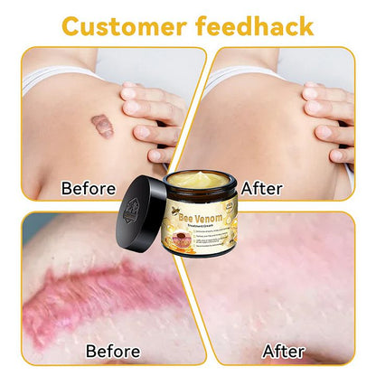Professional Bee Venom Repair Cream, For All Body Parts