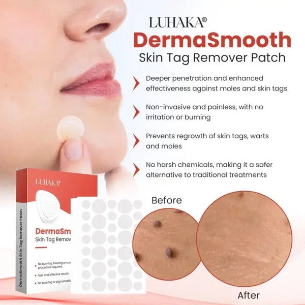 Derma Smooth Skin Tag Removal Patch | 72 Pathces |