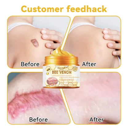 HOUKEA™Bee Venom Cream (Original)